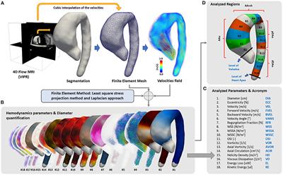 Fully Three-Dimensional Hemodynamic Characterization of Altered Blood Flow in Bicuspid Aortic Valve Patients With Respect to Aortic Dilatation: A Finite Element Approach